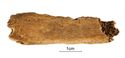 Thumbnail of Figure 6.11: Bainesse Cemetery: Skeleton 12996 (Grave 140), woven bone on pleural surface of rib.