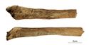 Thumbnail of Figure 6.13: Bainesse Cemetery: Skeleton 13168 (Grave 15) woven and lamellar bone on both distal fibulae shafts.