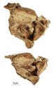 Thumbnail of Figure 6.16: Bainesse Cemetery: Skeleton 12731 (Grave 87), bony growth protruding from floor of left sinus (vertical and oblique view).