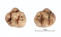 Thumbnail of Figure 6.28: Bainesse Cemetery: Skeleton 12936 (Grave 102), multicusped maxillary first molars.