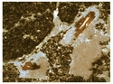 Thumbnail of 5.3.2.9.22 Plant tissue residue (TR) within a void, probably from Poaceae. Sample NB13[1] 1 PPL <br  />(<b>Filename:</b> 5_3_2_9_22_Plant_tissue_residue_Soil_Pit_A2_horizon.jpg)