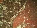 Thumbnail of TP1 3 SMM Plant tissue residue <br  />(<b>Filename:</b> TP1_3_SMM_Plant_tissue_residue.jpg)